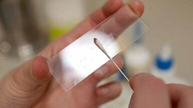 Calais Analysis to identify pests