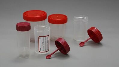 How to prepare for pests testing