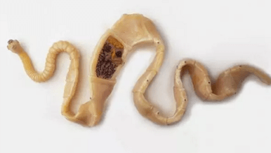 How to discover the presence of pests in the body